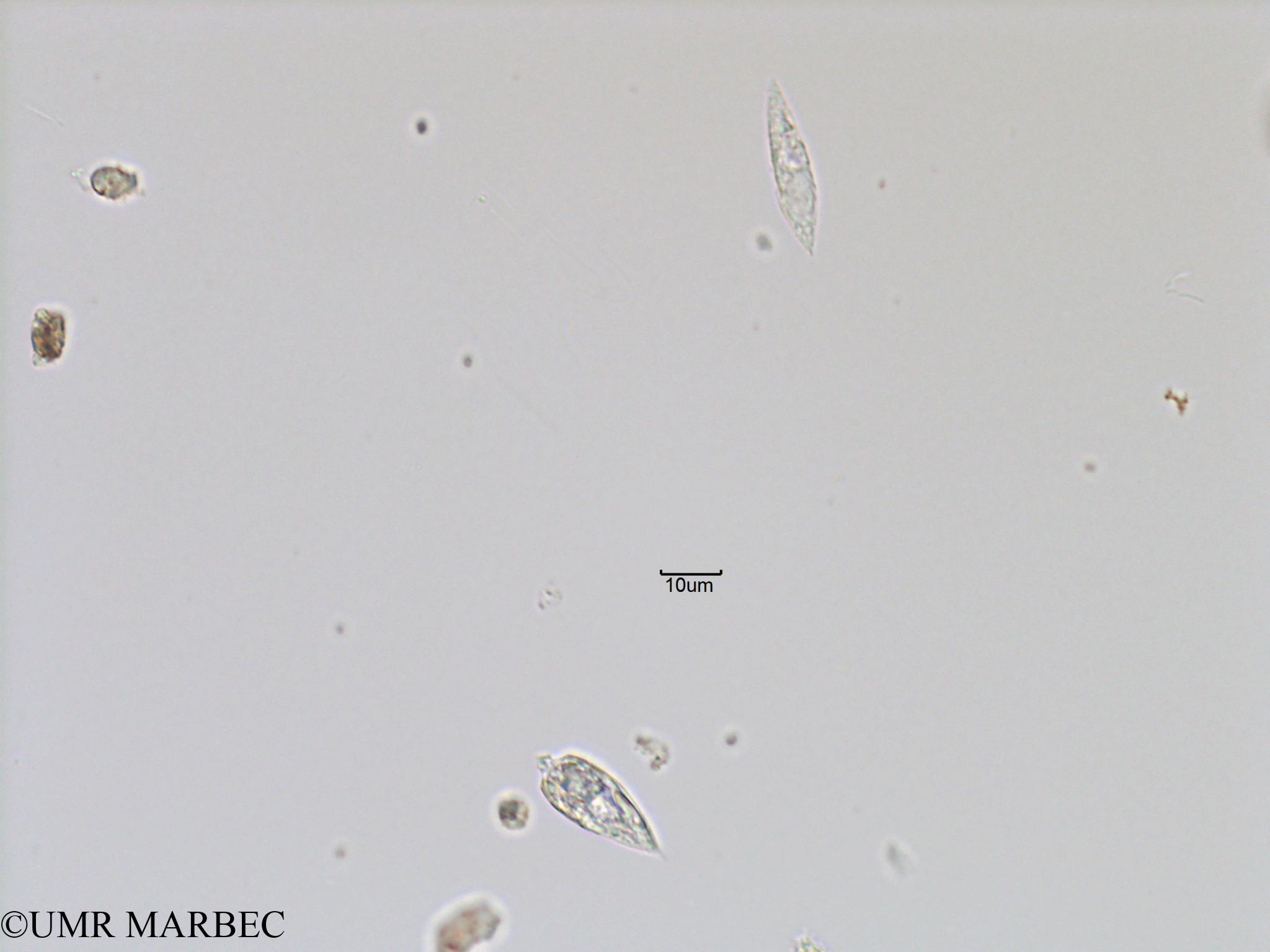 phyto/Bizerte/bizerte_bay/RISCO November 2015/Lessardia elongata et Oxytoxum caudatum (Baie_T5-C1-Gyrodinium et O turbo a verifier).tif(copy).jpg